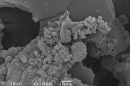Biofilm on a textured implant.
Credit: Surgical Infection Research Group, Australian School of Advanced Medicine