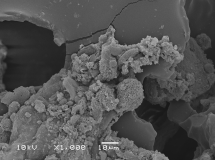 Biofilm on a textured implant.
Credit: Surgical Infection Research Group, Australian School of Advanced Medicine
